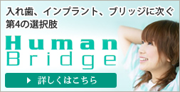 入れ歯、インプラント、ブリッジに次ぐ 第4の選択肢 Human Bridge