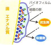 歯のスペシャルケア「PMTC」